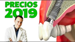 Implantes Dentales PRECIOS 2019 ¿Subirán de precio este año [upl. by Nidia]