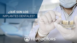 ¿Qué son los implantes dentales [upl. by Zapot]