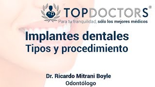 Implantes dentales Tipos de implantes que existen [upl. by Epps]