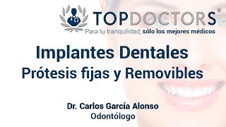 Implantes Dentales Prótesis fijas y Removibles [upl. by Nuahsyd473]